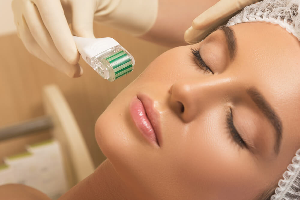 Beauty Microneedling